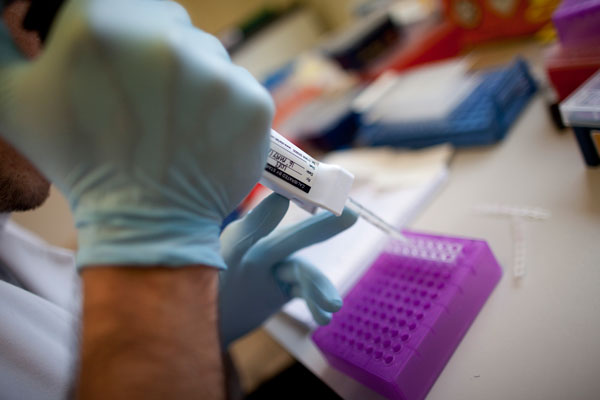 Crean test genético que busca bajar las muertes por cáncer de próstata a la mitad