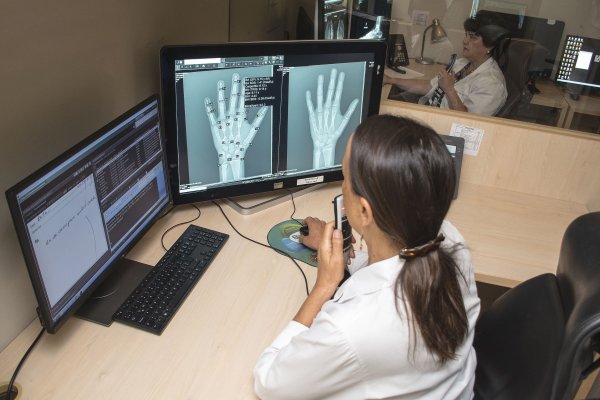 El sistema de inteligencia artificial que optimiza la determinación de la edad ósea en los niños