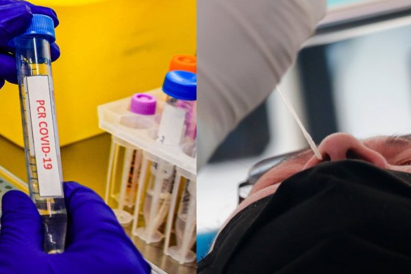 El examen más difícil de los laboratorios ante la alta demanda de los PCR