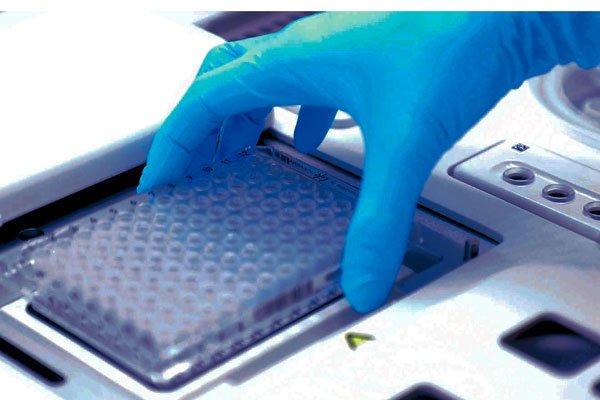 Española Igenomix despliega pruebas genéticas de precisión para 6.000 enfermedades poco frecuentes
