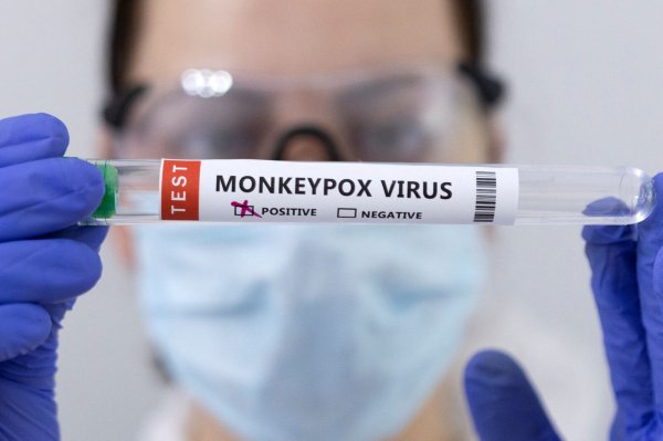 Viruela del mono: qué debe saber sobre el último virus que alarma a los organismos mundiales de salud