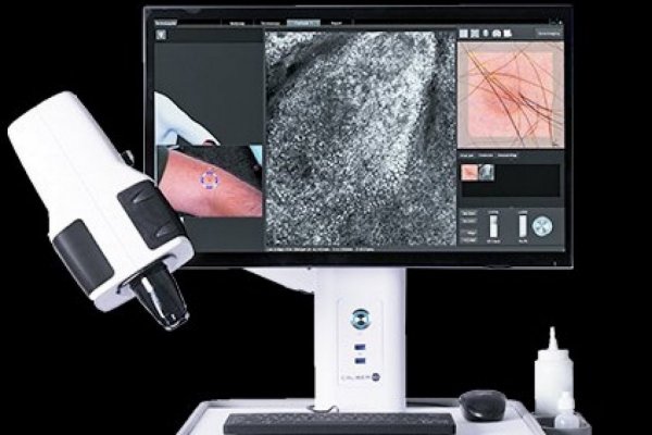 <p>Las nuevas tecnologías conectadas a IA para tratar melanomas, diabetes y salud mental</p>